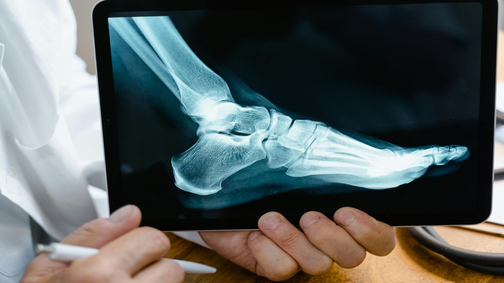 An image of a doctor holding a foot x-ray.